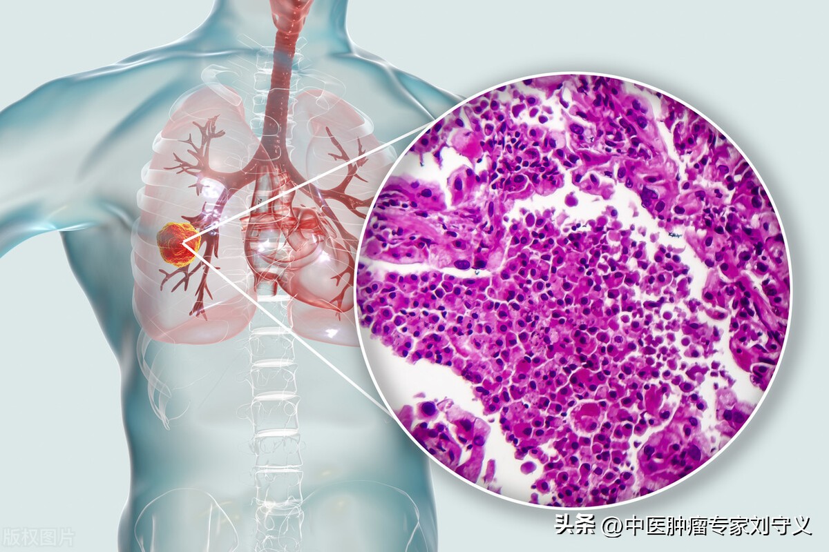 中华医药垂盆草的神奇功效与作用,垂盆草治癌症的吃法