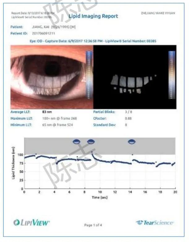 角膜接触镜验配案例图解,戴角膜塑形镜反复出现点染的原因