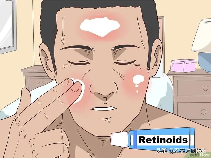 白头怎么快速消除,去白头发最有效的方法有哪些