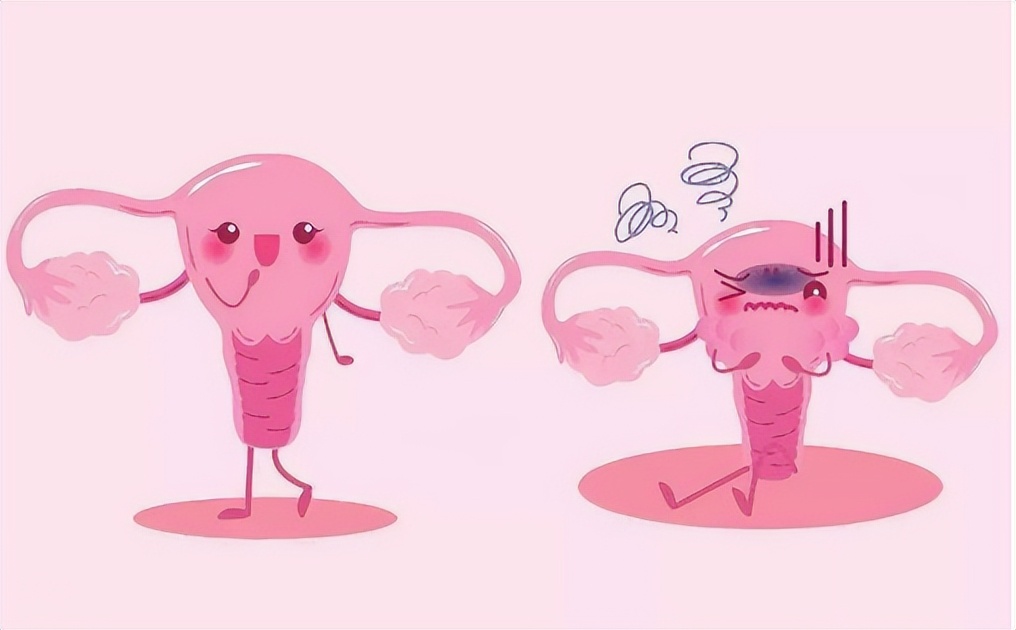 女裤上发黄有异味什么原因,女裤发黄是有妇科病吗