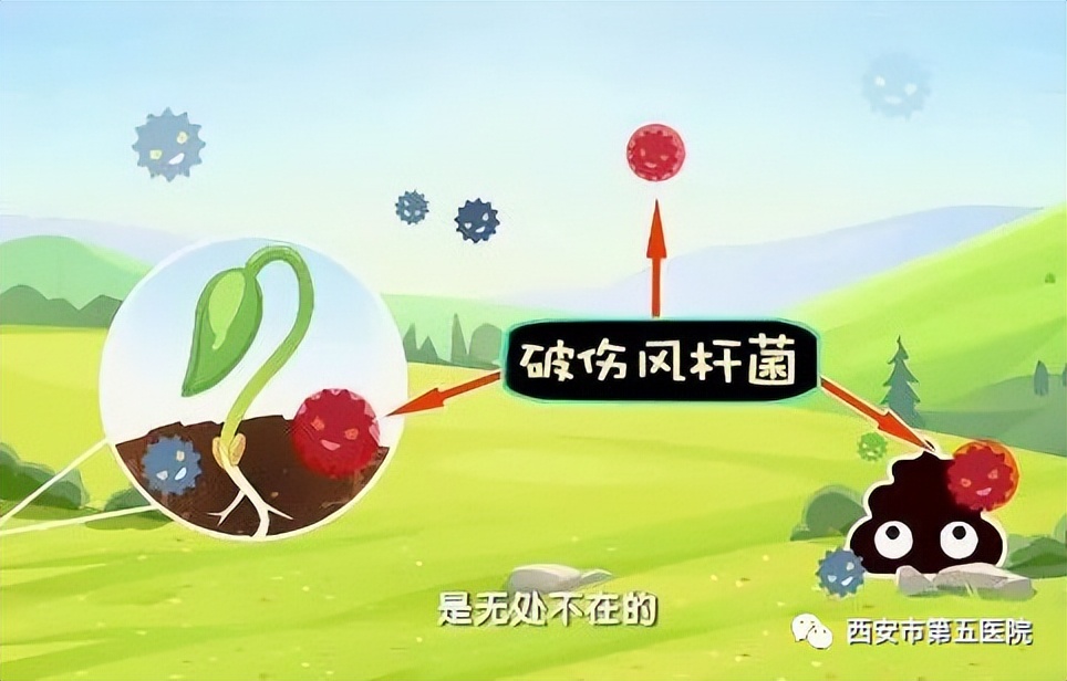 破伤风是伤口受风引起吗,破伤风是伤口吹风引起的吗