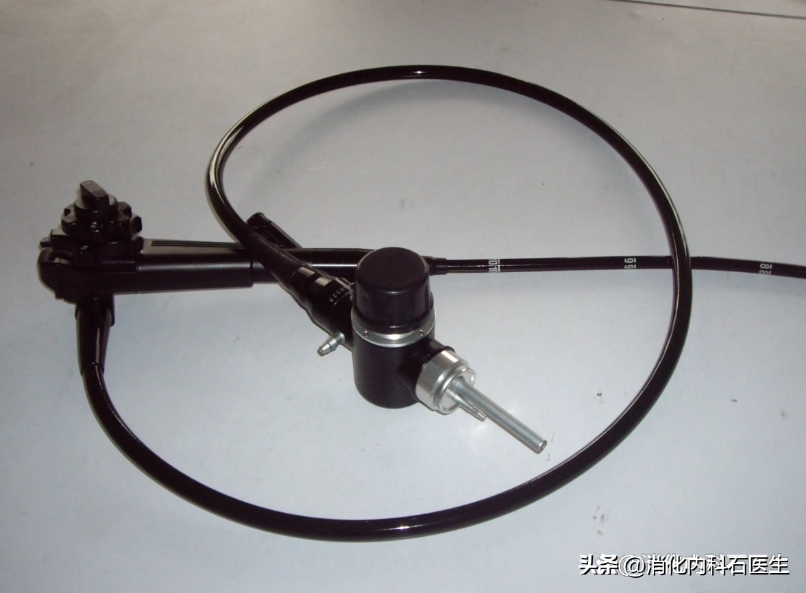 儿童肠息肉2.5公分,小孩结肠息肉用b超能查出来吗