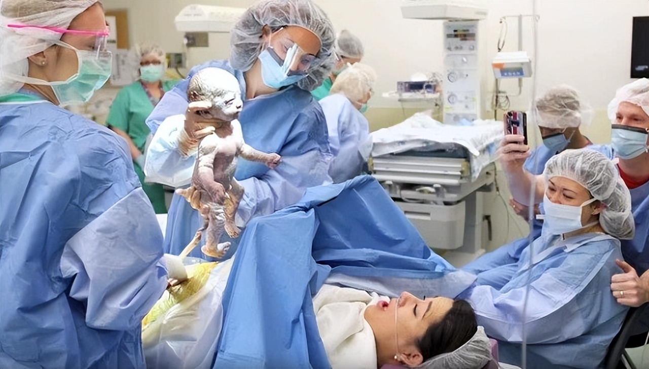 美国产妇水下分娩生下双胞胎,美国孕妇水下分娩双胞胎完整版