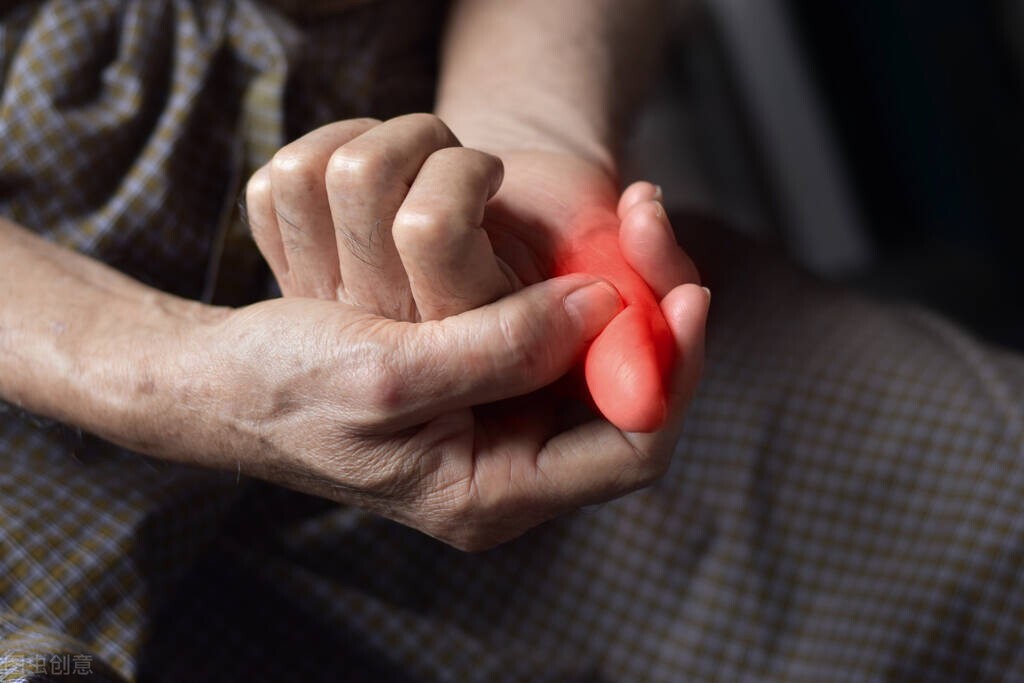 湿疹过敏引起皮肤发红怎么办,治疗湿疹过敏的药有哪些