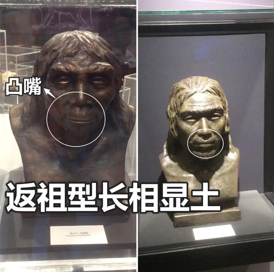 塌山根塌鼻梁怎么拯救,没山根塌鼻梁凸嘴怎么改善