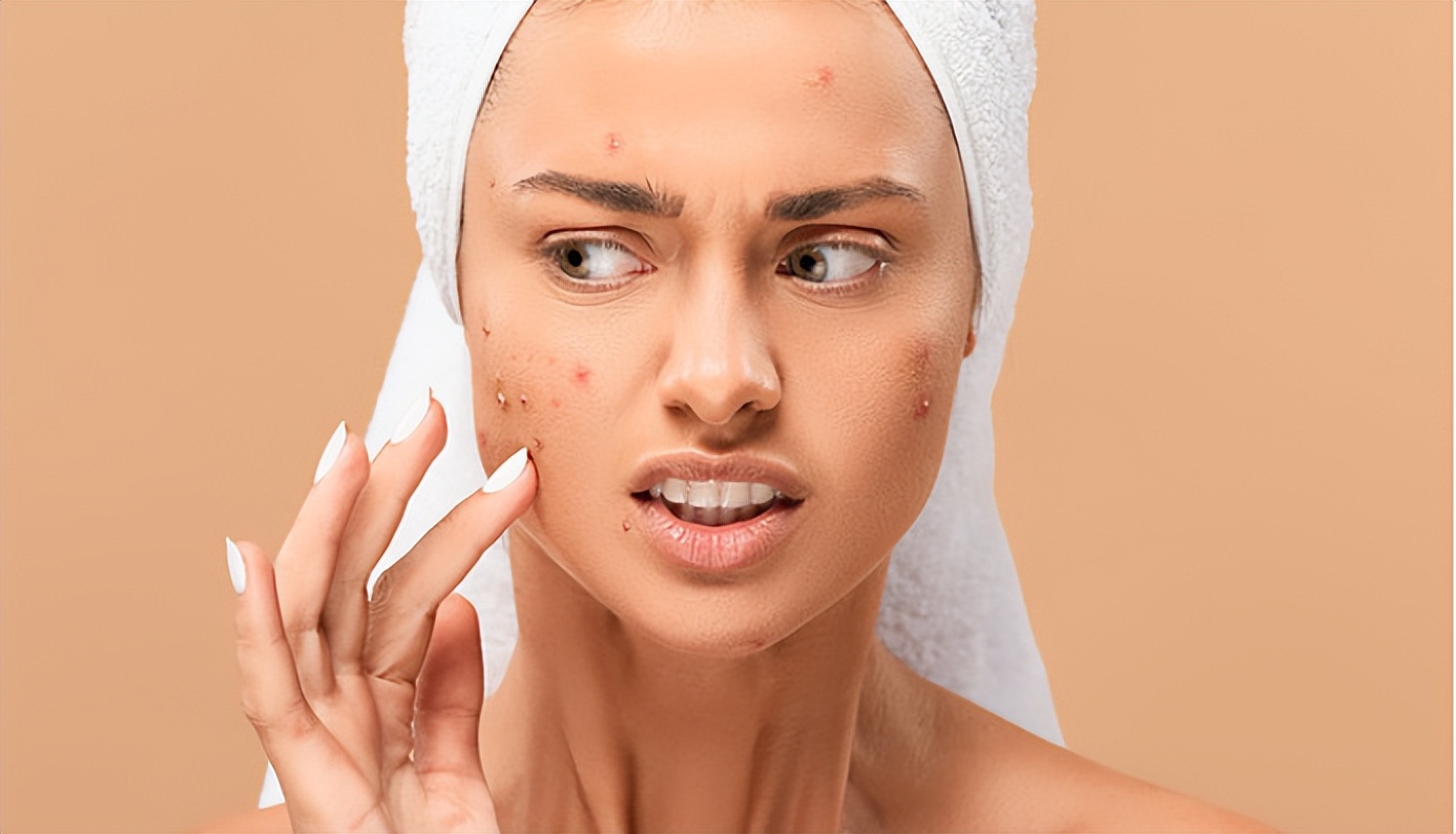 很严重的青春痘要怎样治疗,揭秘青春痘最好的治疗方法