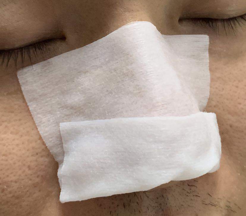 鼻子毛孔堵塞凸起有油脂粒,鼻子毛孔粗大有油脂粒怎么办