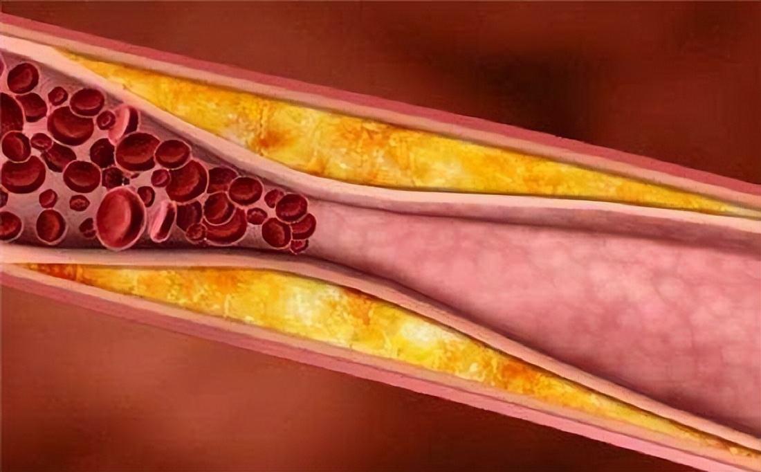 男性160-172标准体重对照表,152-188cm标准体重对照表