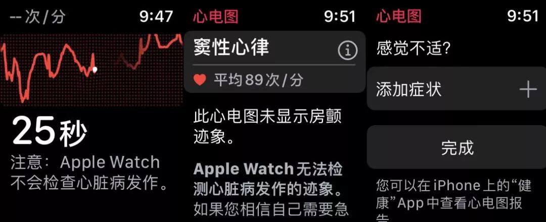 外版的applewatch有心电图功能吗,applewatch心电图有几个功能