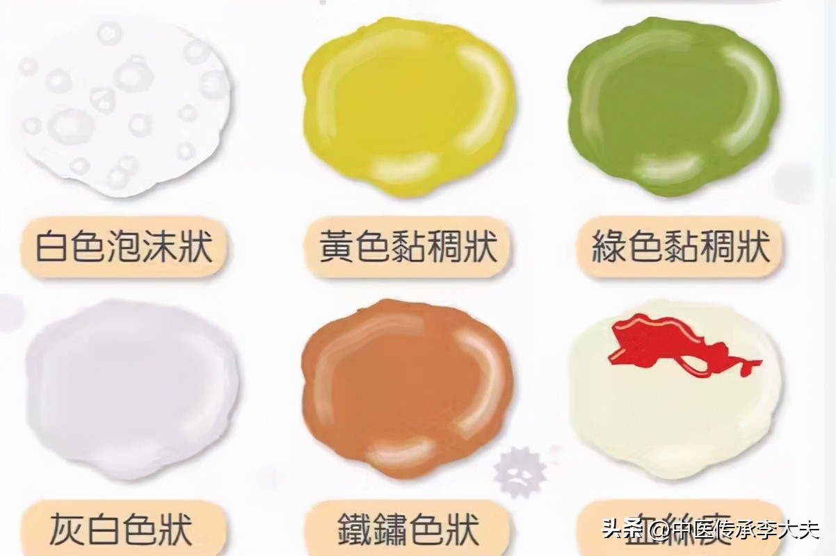 燥咳干咳无痰应用啥中药,黄痰浓稠干咳用什么中药