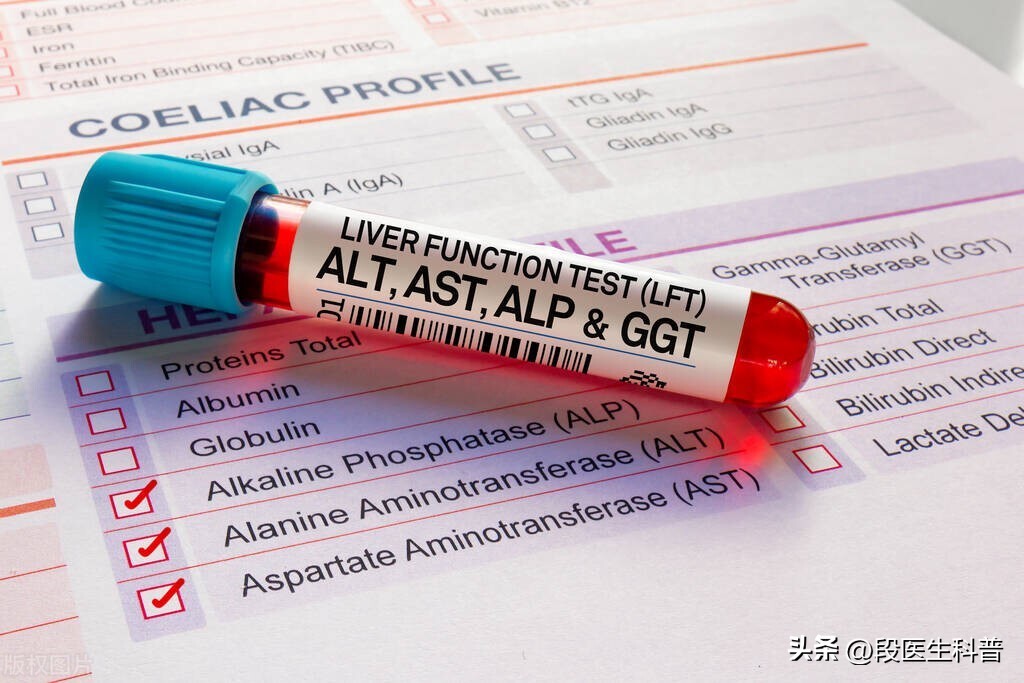 转氨酶升高怎么处理,转氨酶升高怎么知道是什么原因