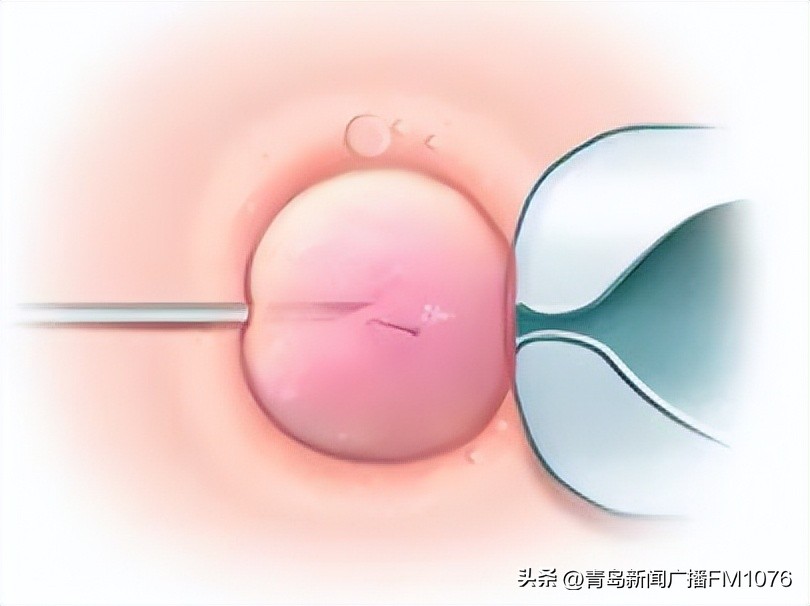 揭秘试管婴儿孕育全过程,试管婴儿诞生原理