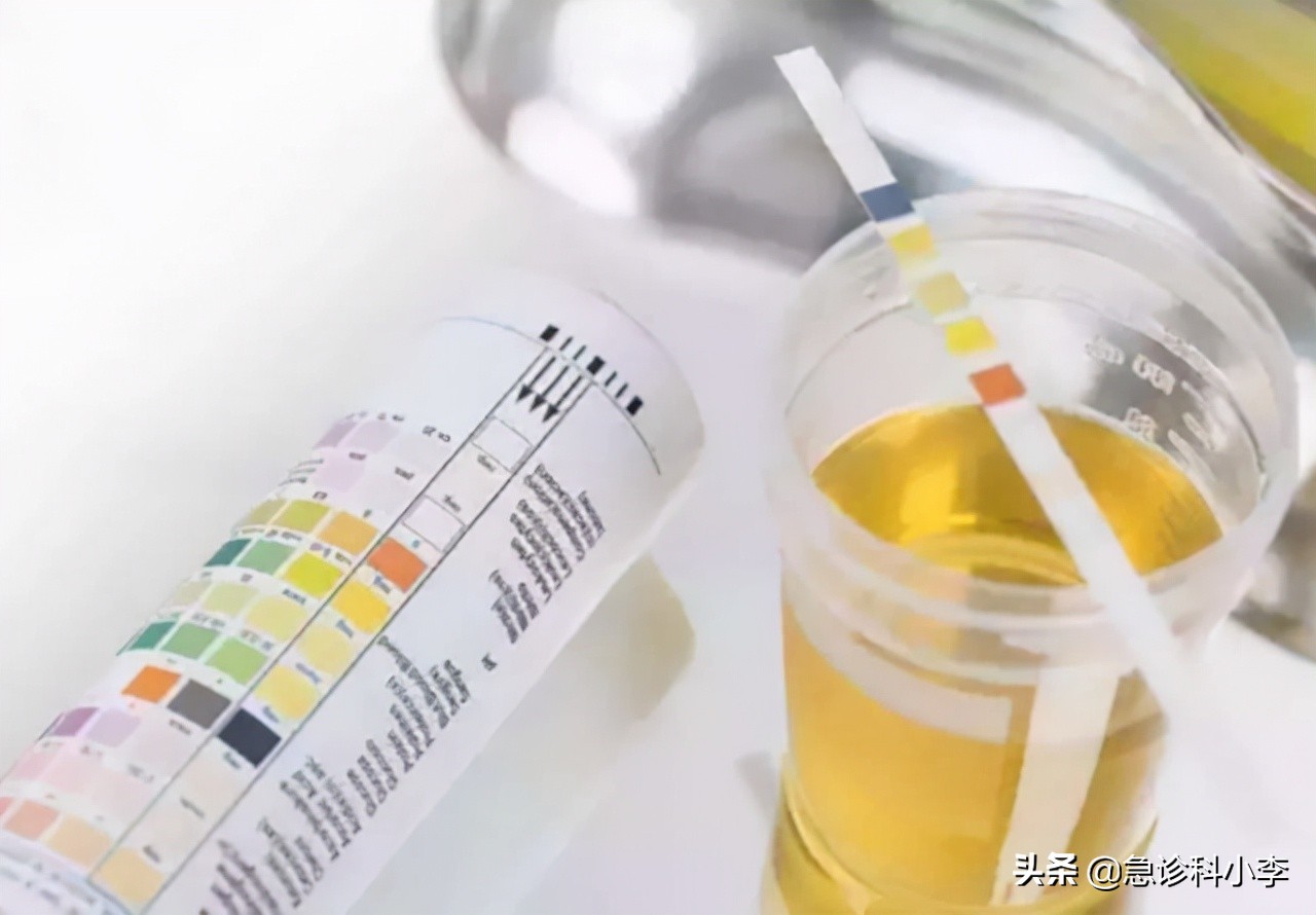 12岁女孩患尿毒症每天坚持透析,妈妈患尿毒症透析