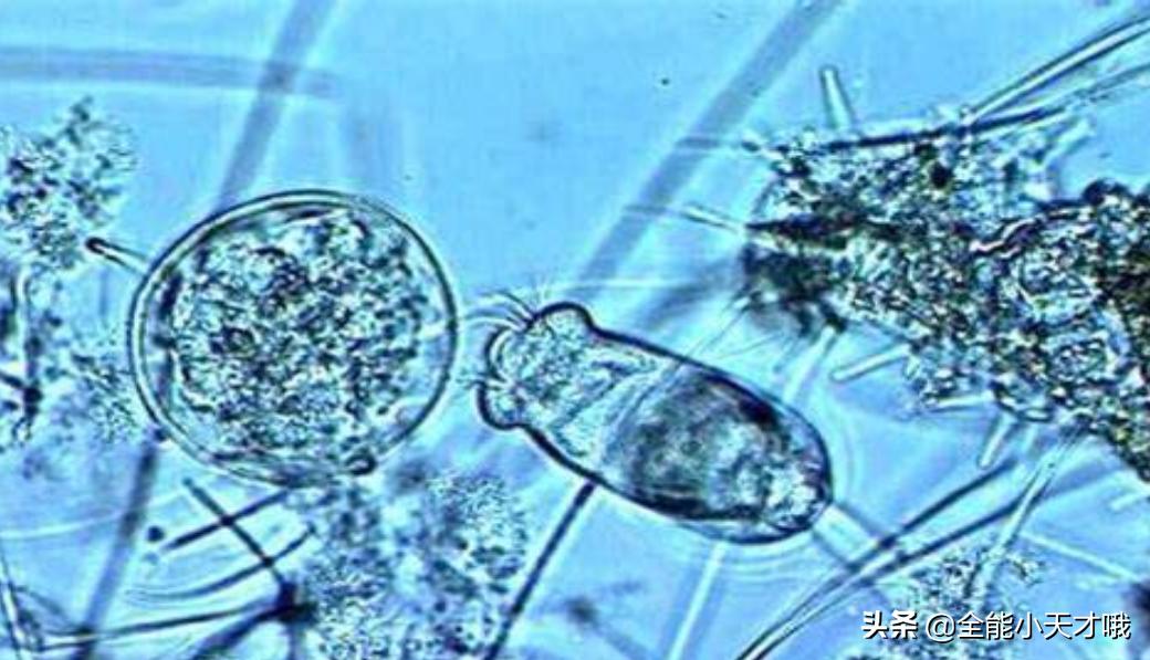 虾塘车轮虫最佳治疗方法,水产养殖中怎么预防纤毛虫