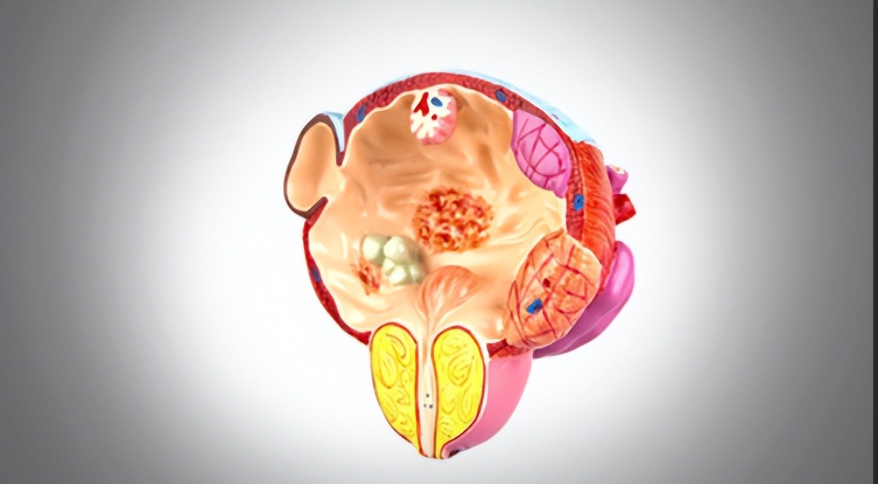 中医治疗不孕症最佳方法,中医治疗不孕不育有治疗好的吗