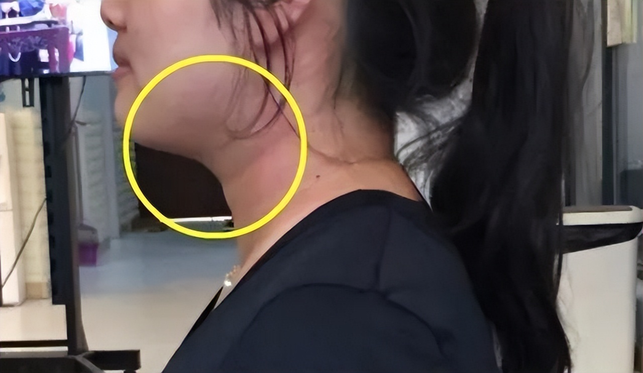 面部衰老的这五种表现你有吗,面部衰老的5个信号你出现了吗