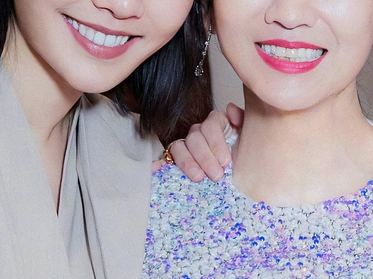 明星做烤瓷牙把真牙去掉吗,明星的烤瓷牙是怎么弄的