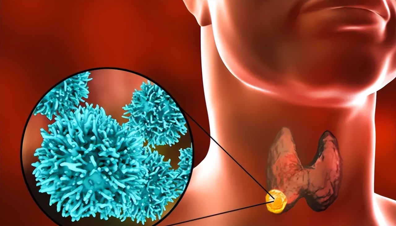 肿瘤界争议,肿瘤病不可怕疾病都是可防可治的