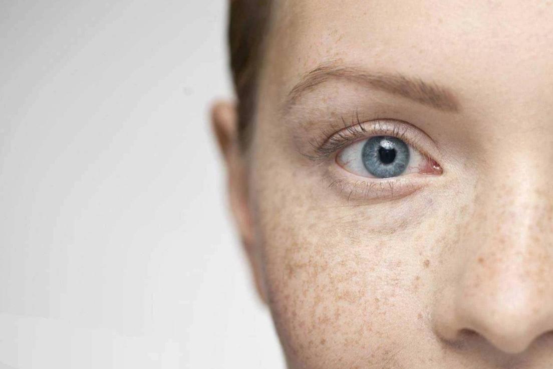 长黑眼圈是身体哪里出问题了吗,长黑眼圈和斑是什么原因