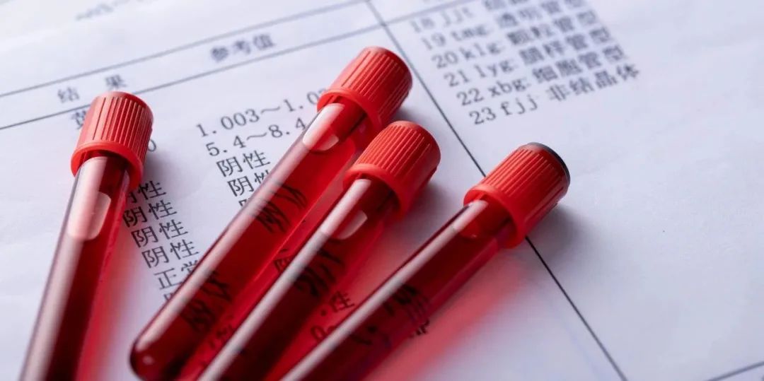 2022卵巢癌nccn指南解读,2018nccn卵巢癌指南解读