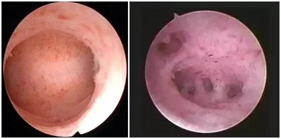 你知道宫腔镜是治疗什么的吗,宫腔镜是治疗什么的