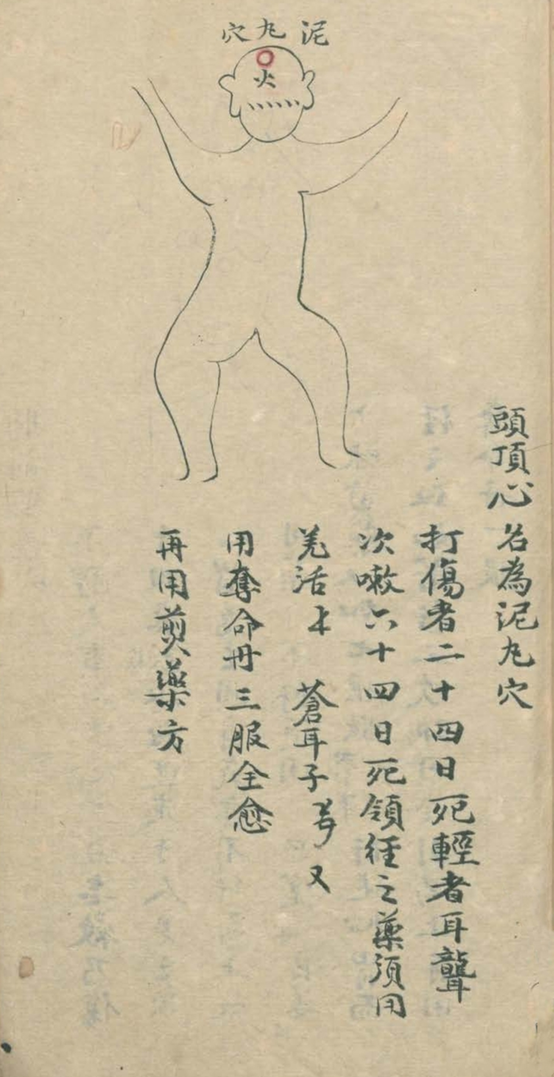 武当秘传跌打八法,民间中医古籍手抄本专医跌打秘方