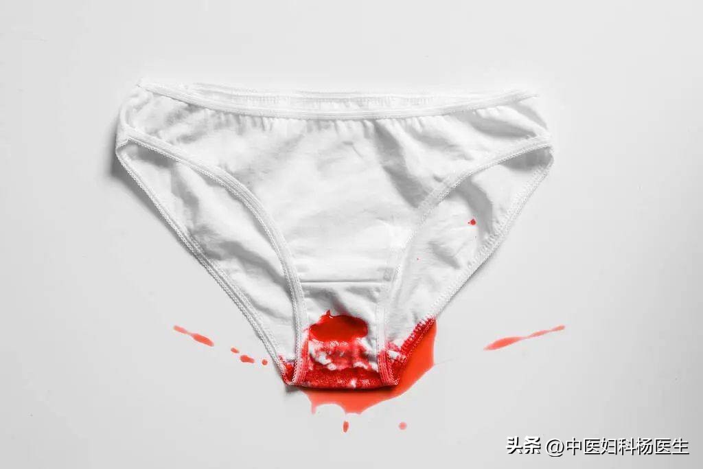48岁女子绝经后出血，竟是宫颈癌晚期医生：3种情况，越拖越要命