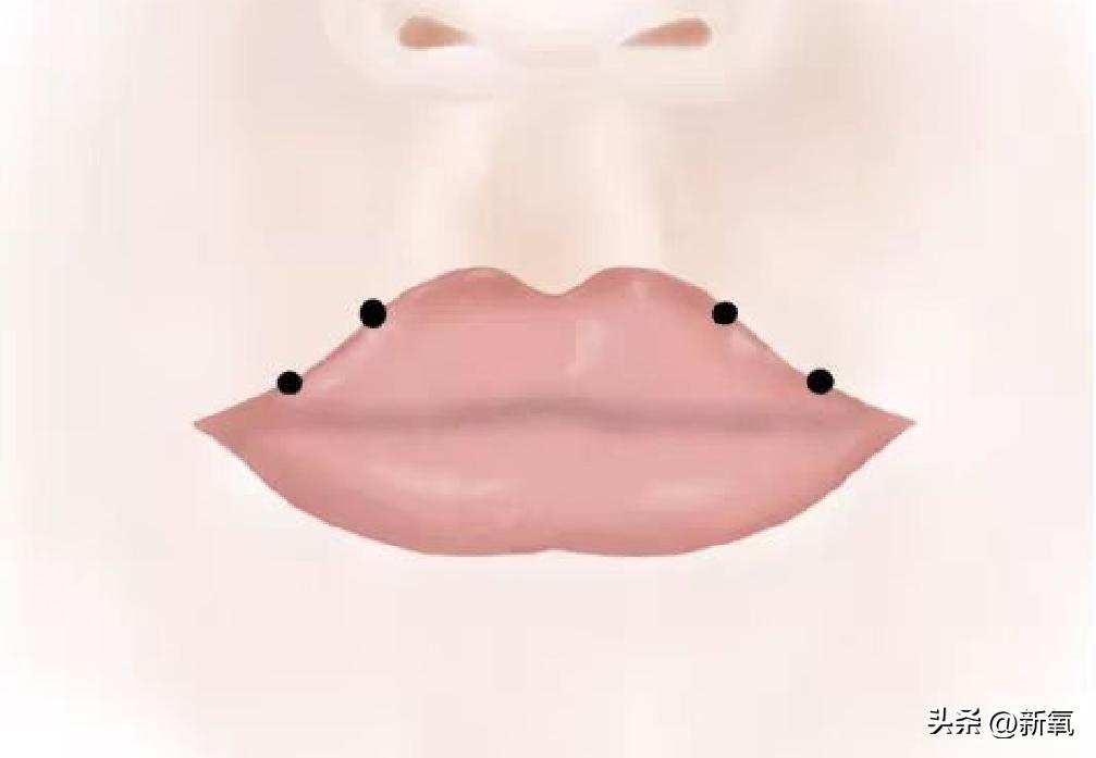 嘴唇薄变丰满,嘴唇变凸变丑怎么办