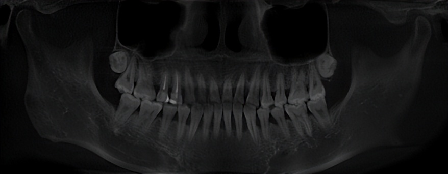 济南可恩口腔医院种牙,可恩口腔跟山东大学口腔哪个好