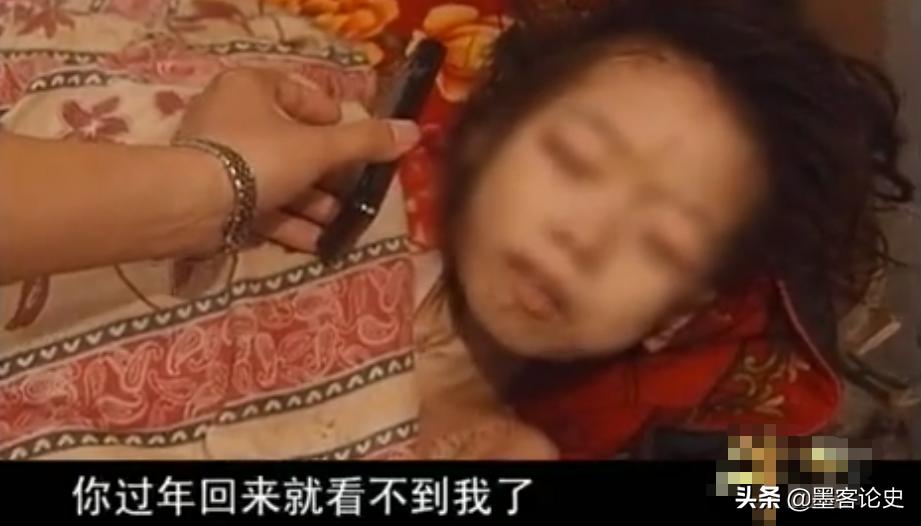 四川11岁骨结核女孩现状,四川11岁女孩骨结核