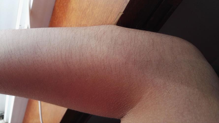 高考女生吃避孕药有副作用,高考女生需要吃抑制姨妈的药物吗