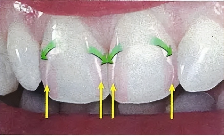 2022飞利浦儿童电动牙刷哪个好用,飞利浦儿童电动牙刷推荐测评