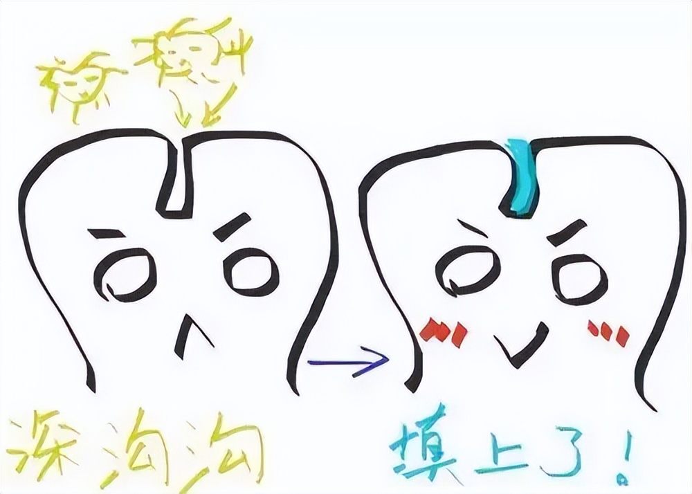@所有家长:十个孩子九个蛀牙?只要做到这两点就可以避免