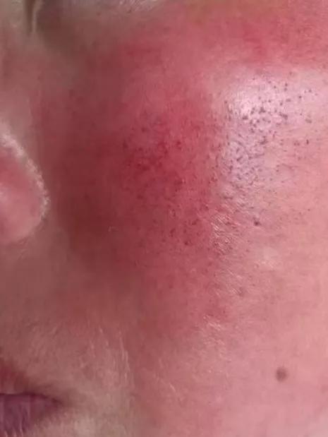 护肤踩坑没效果,沉浸式护肤的坑