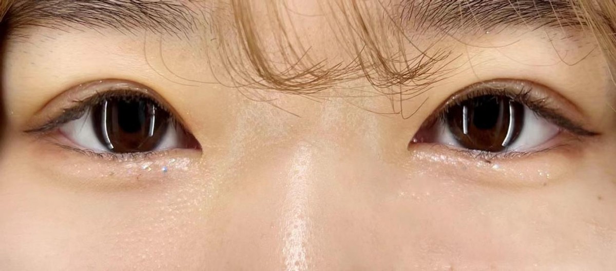 单眼皮肿眼泡该不该割,单眼皮肿眼泡真的不适合珠光色吗