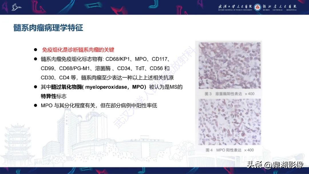 阴道肉瘤的早期症状,阴道里长肉瘤是啥症状