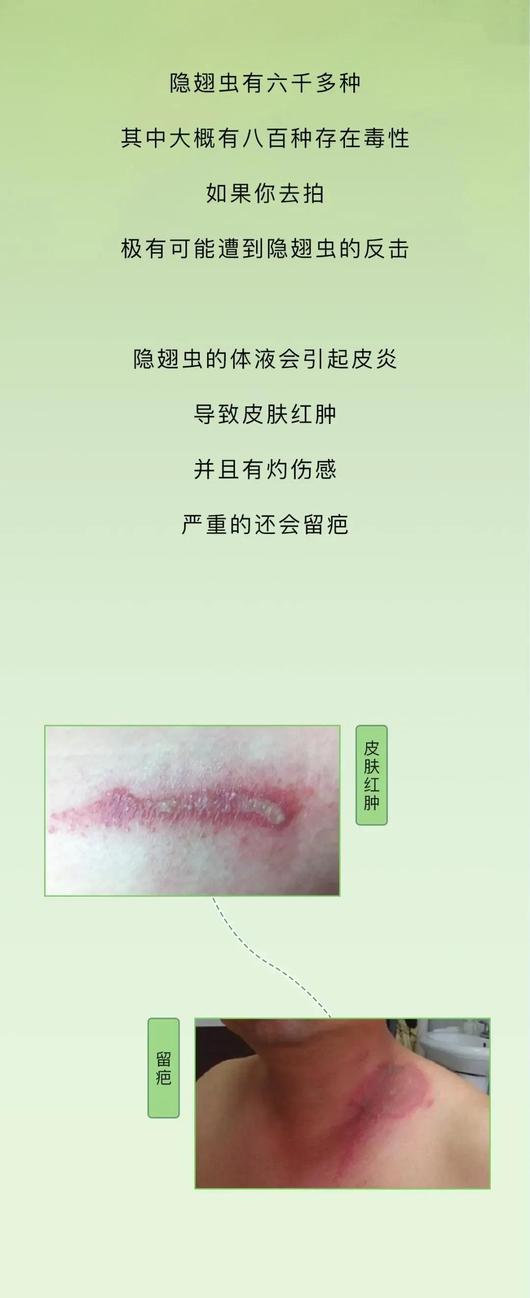 最近看到这些虫子，不要随便拍，建议提前了解（漫画讲解）