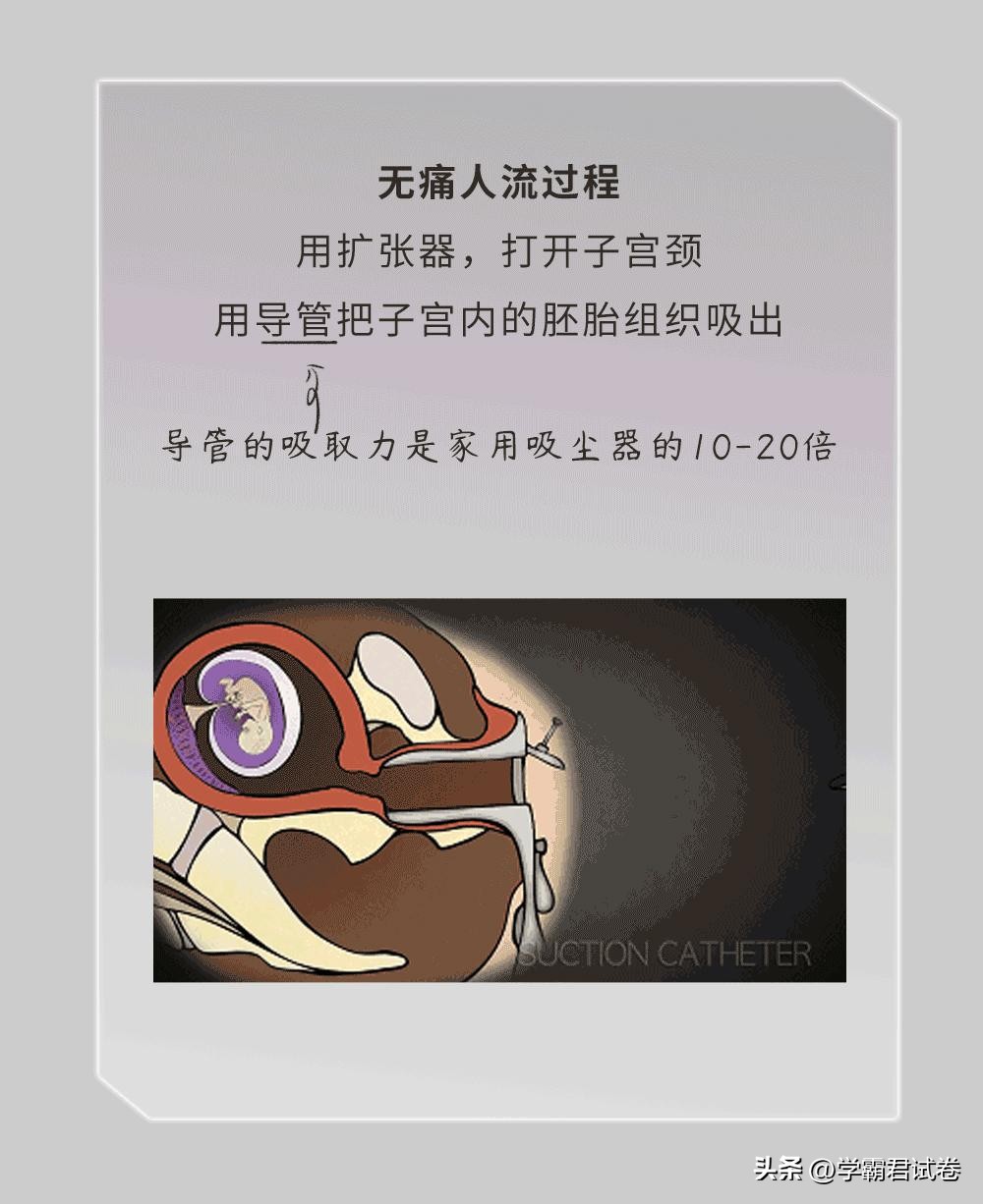 为何总有女生会意外怀孕？或许是安全期惹的祸（漫画）