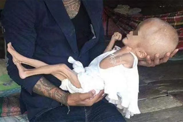 三鹿奶粉事件婴儿现况,三鹿奶粉事件结果