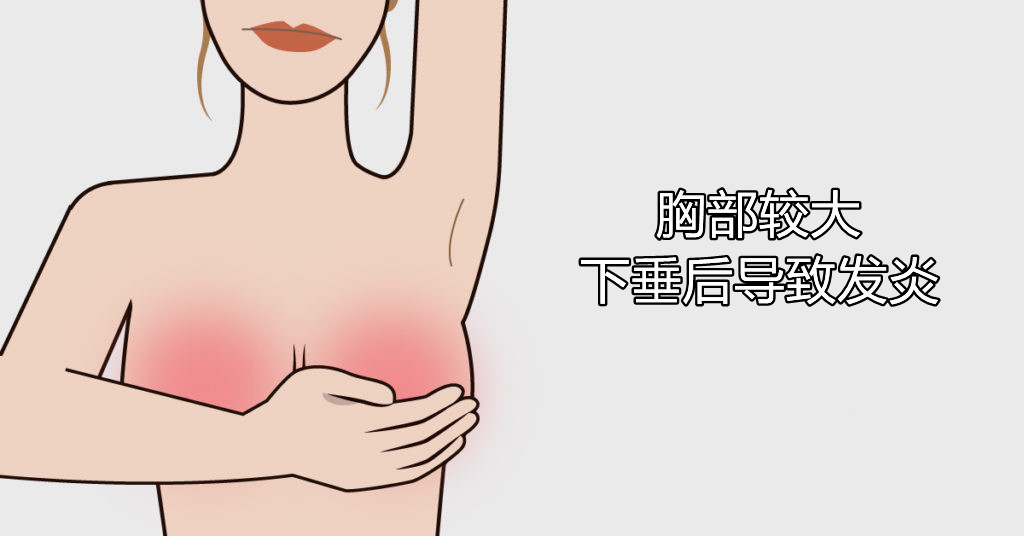女子胸过大做缩胸手术,胸部比较大容易造成什么影响