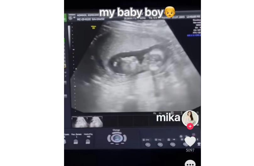 泰国做变性手术网红,泰国变性手术后康复的网红视频