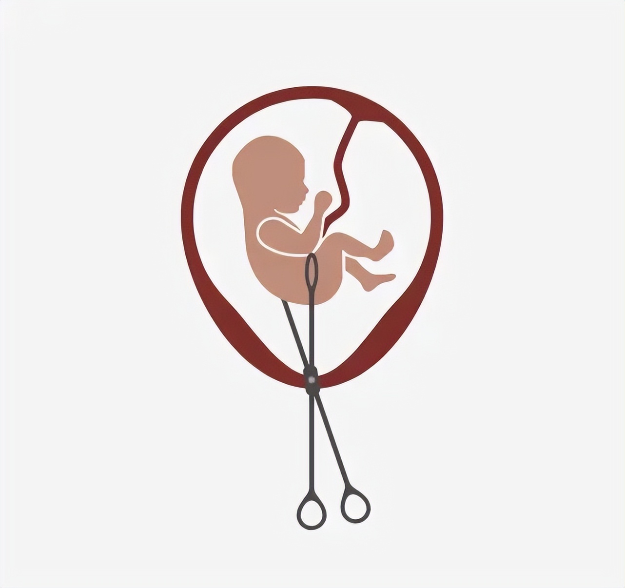 人工流产注意事项及术后康复,人工流产手术危害与风险