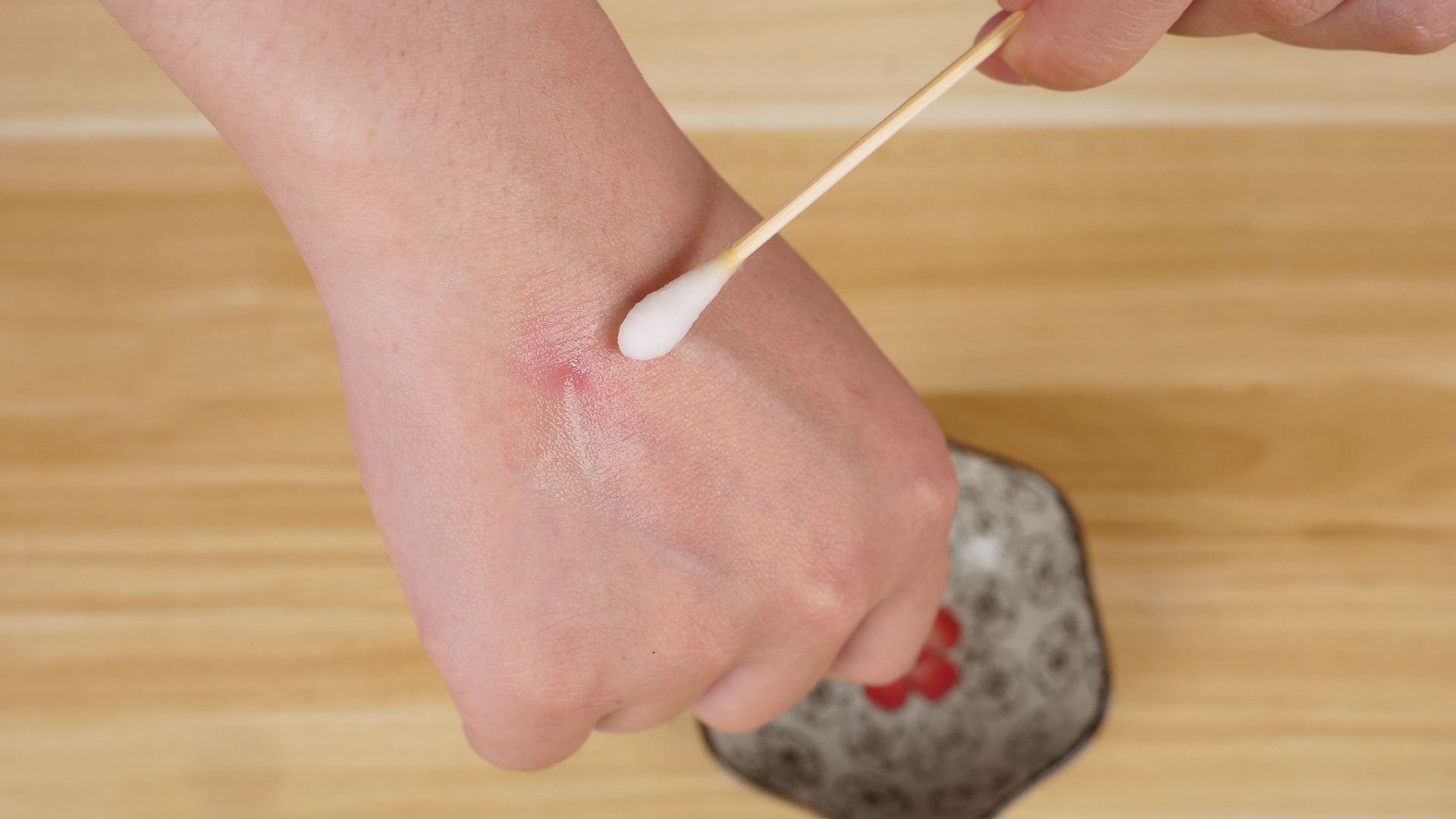 红霉素软膏多少钱有什么作用,1元一支的红霉素软膏还有大用途