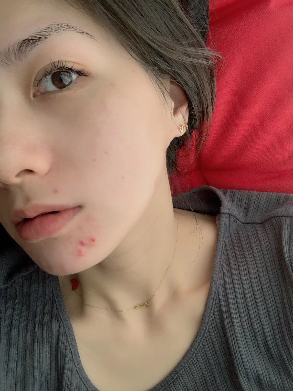 脸上有痘痘怎么化妆才能遮得住,脸上都是痘痘和痘印怎么化妆新手