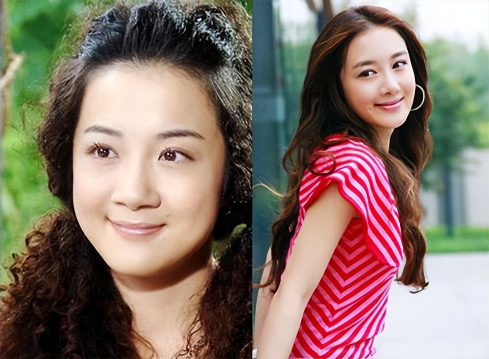 哪些明星整容后遗症越来越严重,整容明星后遗症对比图片