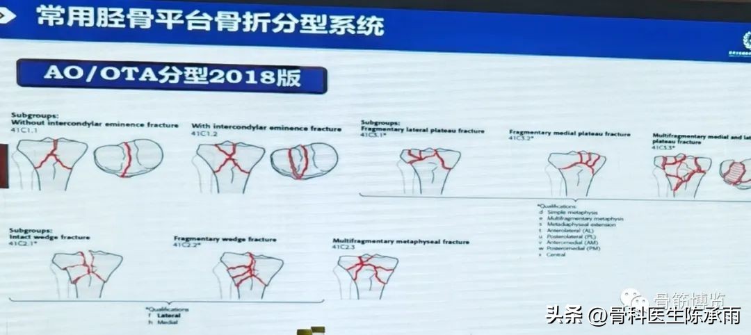 国家卫健委主办的骨创伤专项能力培训项目----下肢损伤学习班