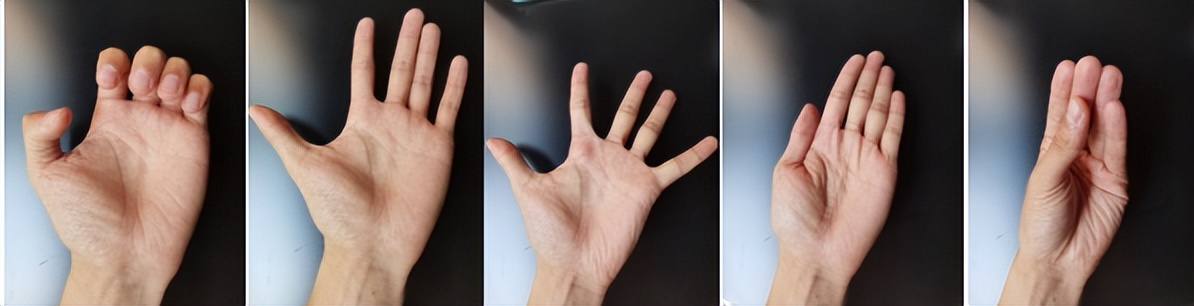 桡骨远端骨折的护理方法,手腕桡骨远端骨折后的恢复过程