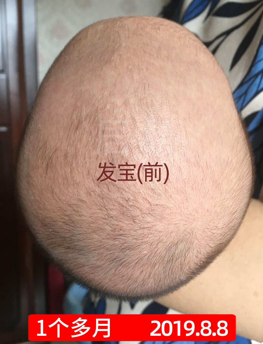 菱形头宝宝头型怎么矫正,上尖下扁头型宝宝头型怎么调整