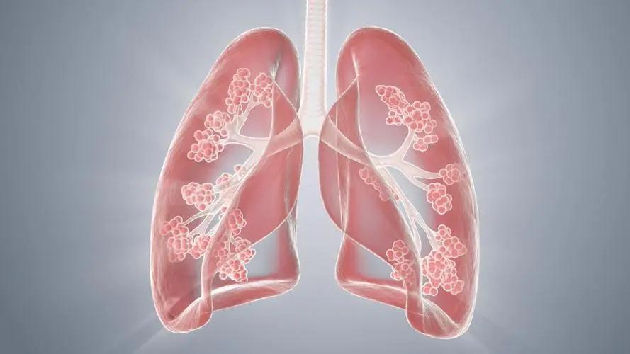 肾绝而齿长全文,肾绝齿长出处