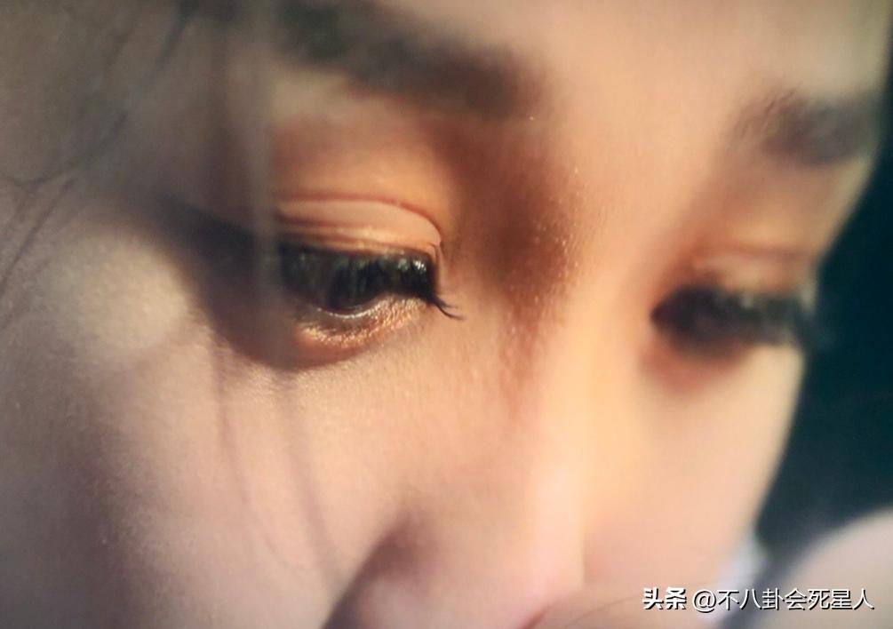 假双眼皮的明星,明星的假脸